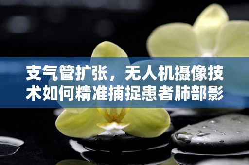 支气管扩张，无人机摄像技术如何精准捕捉患者肺部影像？