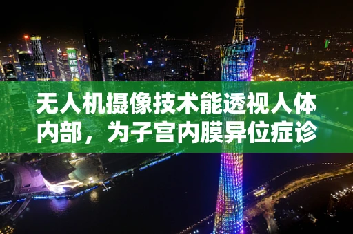 无人机摄像技术能透视人体内部，为子宫内膜异位症诊断带来新视角吗？
