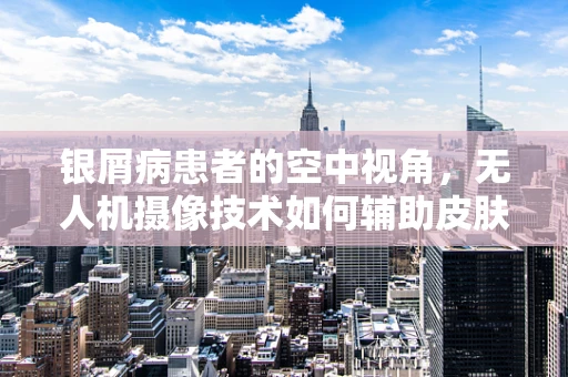 银屑病患者的空中视角，无人机摄像技术如何辅助皮肤监测？